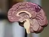 Your brain may be one organ today, but scientists have uncovered a hidden split that may date back more than 500 million years
