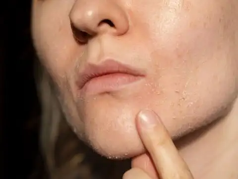 Your Body Is Inflamed And You Can't See It