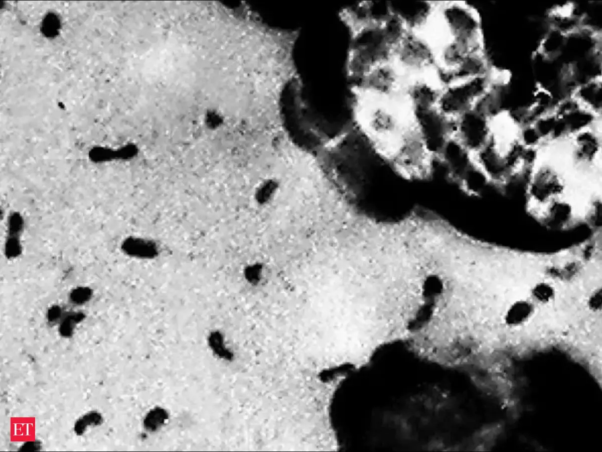 Siberia Lab Death Sparks Bubonic Plague Fears