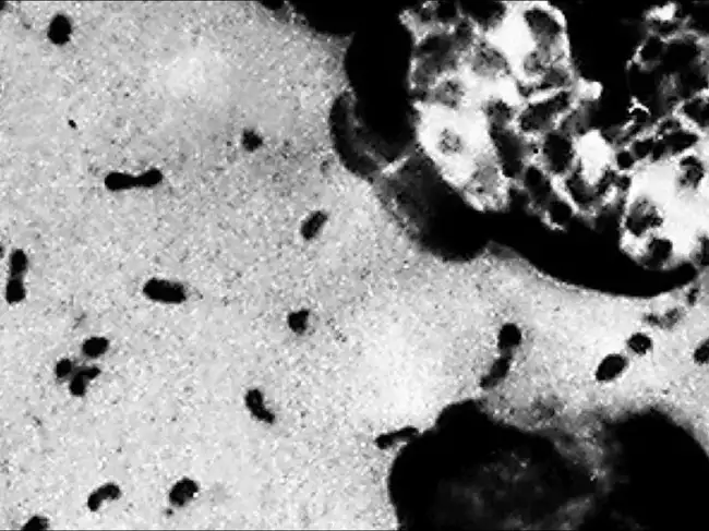 plague bacteria