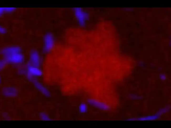 ‘Life goes on’: Scientists describe how ‘zombie’ bacteria keep pumping ...