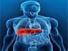Virtual Liver may be cure for drug failures in clinical trials