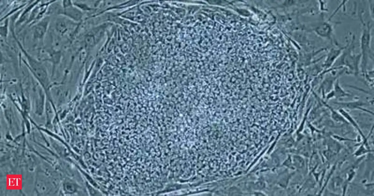 Scientists make breakthrough in human cloning, research may help for ...