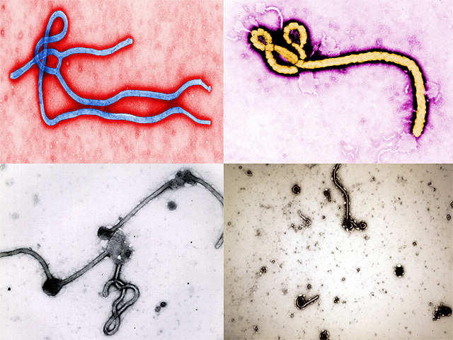 What's scary about Ebola & reasons not to fear it