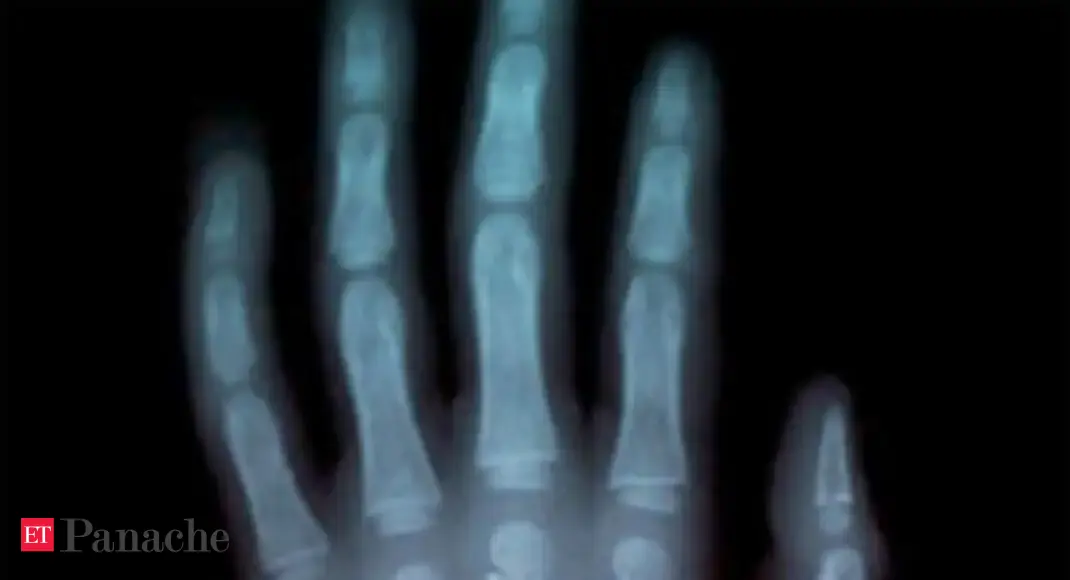 Blackberry Thumb The Economic Times