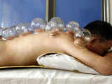 Cupping treatment in Shanghai