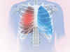 Ibuprofen may lower lung inflammation