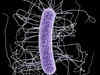 Common bacteria may become antibiotic-resistant superbugs