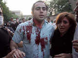 An injured protester during demonstration