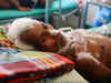West Bengal Health Minister blames Centre for encephalitis deaths