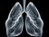 New method developed to produce 3D images of lungs