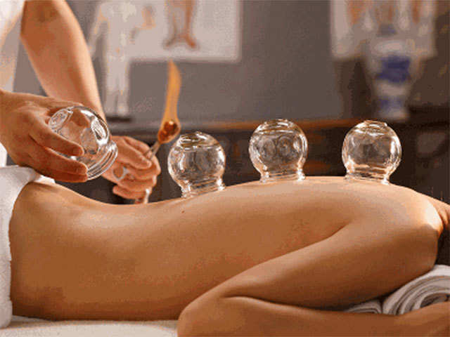 All you need to know about cupping therapy