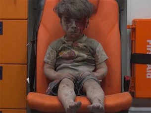 The face of Syria's suffering