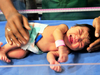 With under-5 mortality down, India set to achieve its MDG