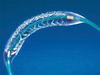 NPPA likely to put ceiling on stent prices by mid-February