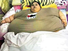 New Rs 2-crore ‘hospital’ for surgery of 500-kg Egyptian woman