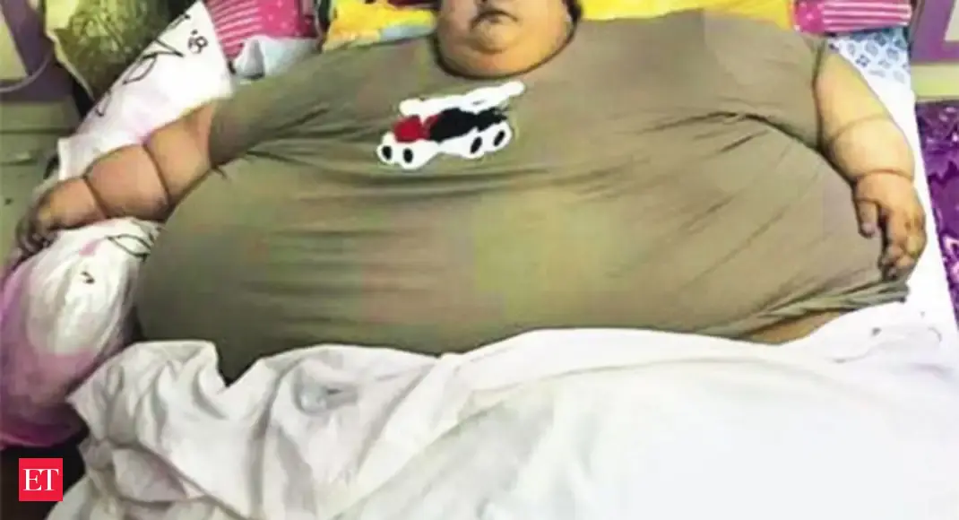 The Fattest Person In The World