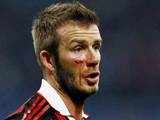 David Beckham bleeds from his cheek