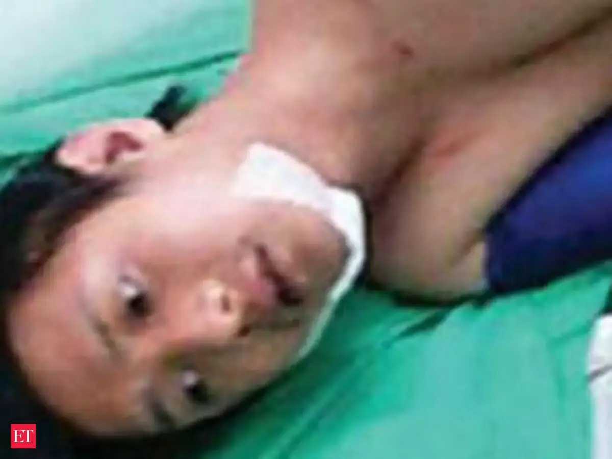 Student from Arunachal abused, thrashed by landlord in Bengaluru - The ...