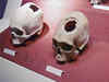 Now, robot drill for 50 times faster skull surgery