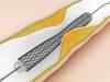 Abbott allowed to discontinue dissolvable stent in India