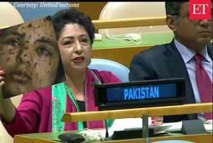 Pakistan flashes fake image of 'pellet gun victim' to malign India at the UN