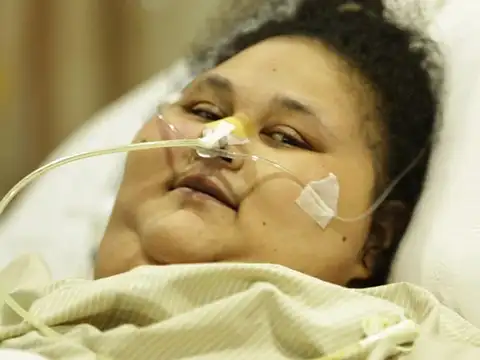 Bariatric surgery in Mumbai