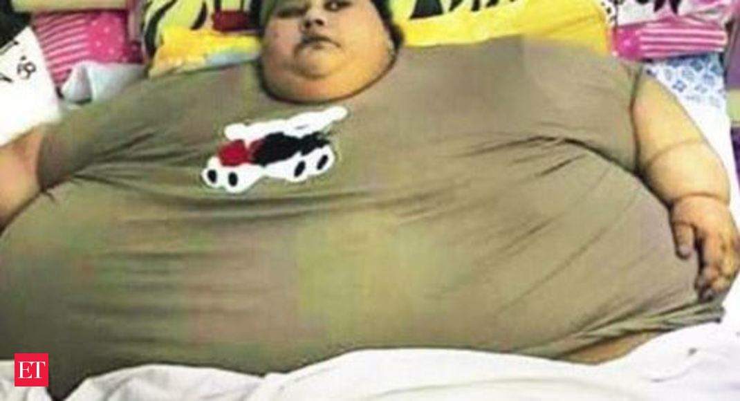 Egyptian Eman Ahmed Once Worlds Heaviest Woman Dies In Abu Dhabi The Economic Times Video 