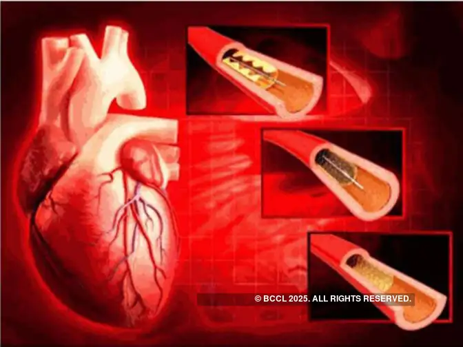 Government forbids cos from withdrawing stents until December to prevent shortage