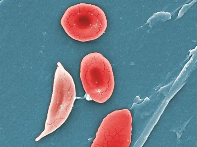 Mental Illnesses Share Genetic Similarities
