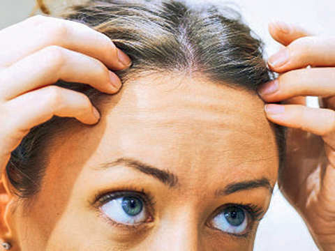 How hair loss can impact your mental health  Health  Hindustan Times