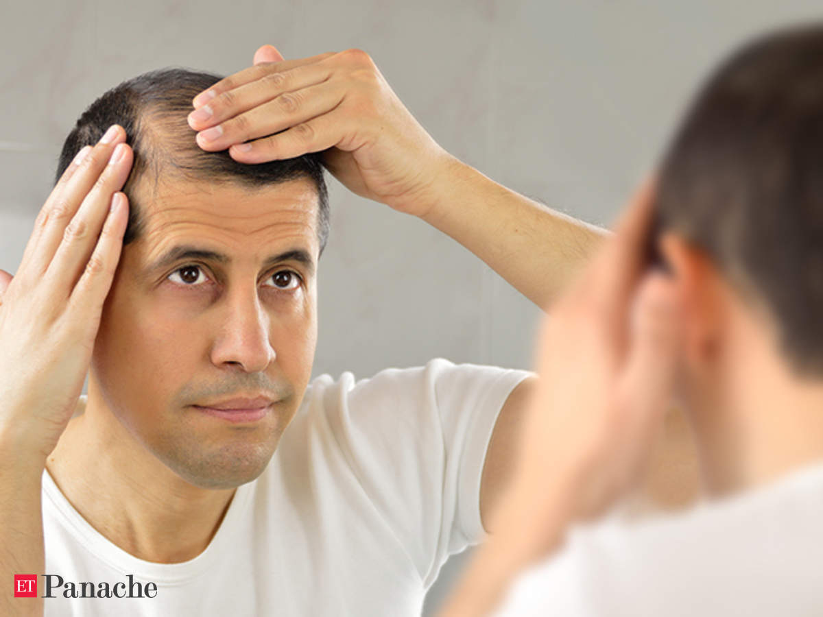 hair transplant: Indian men tackling baldness as early as in their 20s -  The Economic Times