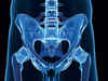J&J’s subsidiary hip replacement row: A detailed timeline of events that hit this global giant