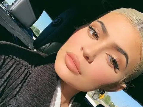 Kylie Jenner Lip Challenge