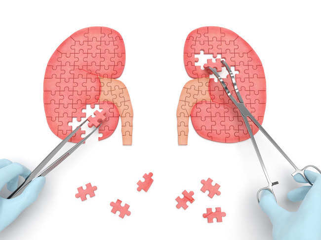 kidney-GettyImages-48575696