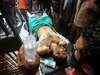 Man injured in Jammu bus stand grenade attack dies, toll rises to two