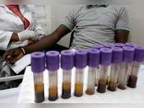 A biologist technician of BIO-MEDICAL, a center that provides medical visits for people who pass the driver's license, carries out a blood test, in Abidjan