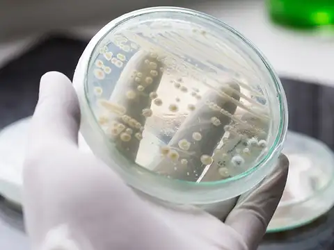 Risk of Candida Auris 