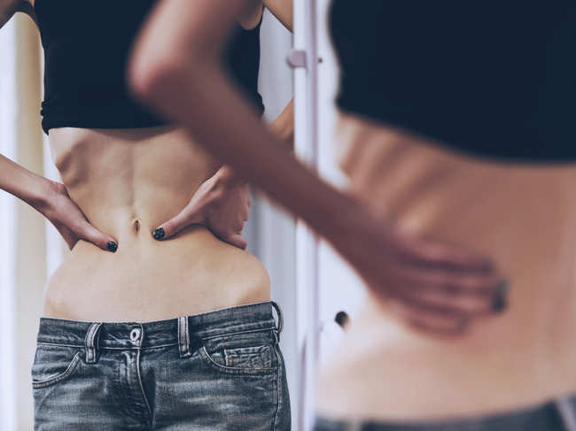 The researchers said​ that attempts to treat anorexia ​ as a mental illness have largely failed.