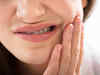 Maintain oral health: Painful gums, mouth ulcers can increase risk of liver cancer