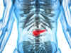 Medical marvel: Inducing this molecule in the body can kill pancreatic cancer cells by 90%