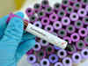Coronavirus: Karnataka breathes easy as tests find samples of five persons negative