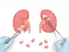 MYTH: Kidney Disease Is Curable