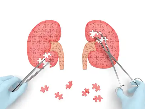 MYTH: Kidney Disease Is Curable 