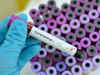 Coronavirus cases in India soar to 562
