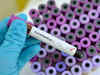 38 coronavirus cases in Gujarat; over 1 cr tracked under surveillance programme