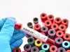 Where to get tested?