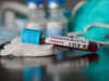ICMR DG asks health secy to disseminate advisory on rapid antibody tests