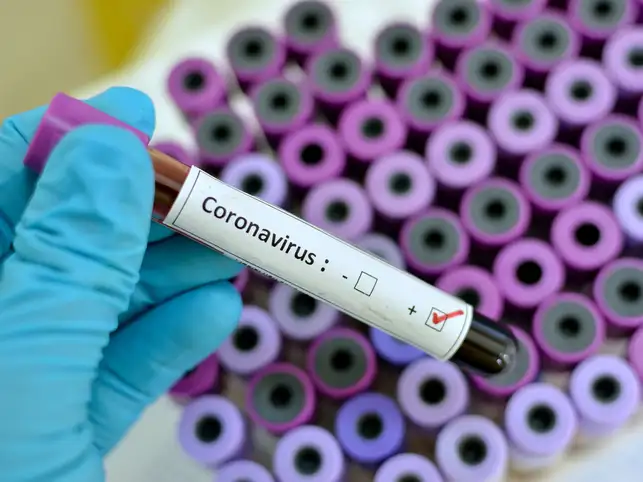 Since the most common consequence of the spread of Covid-19 is quarantine, puns on that word are predictably prolific.