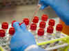 Antibody test kits: After China issues, govt taps 3 nations